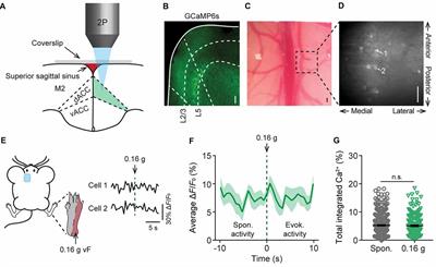 Neuropathic Pain Causes Pyramidal Neuronal Hyperactivity in the Anterior Cingulate Cortex